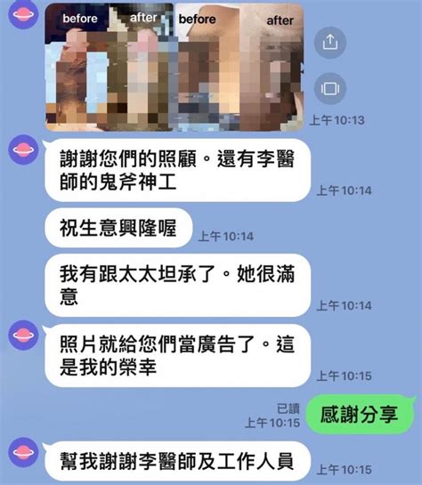 龜頭意思|人類陰莖